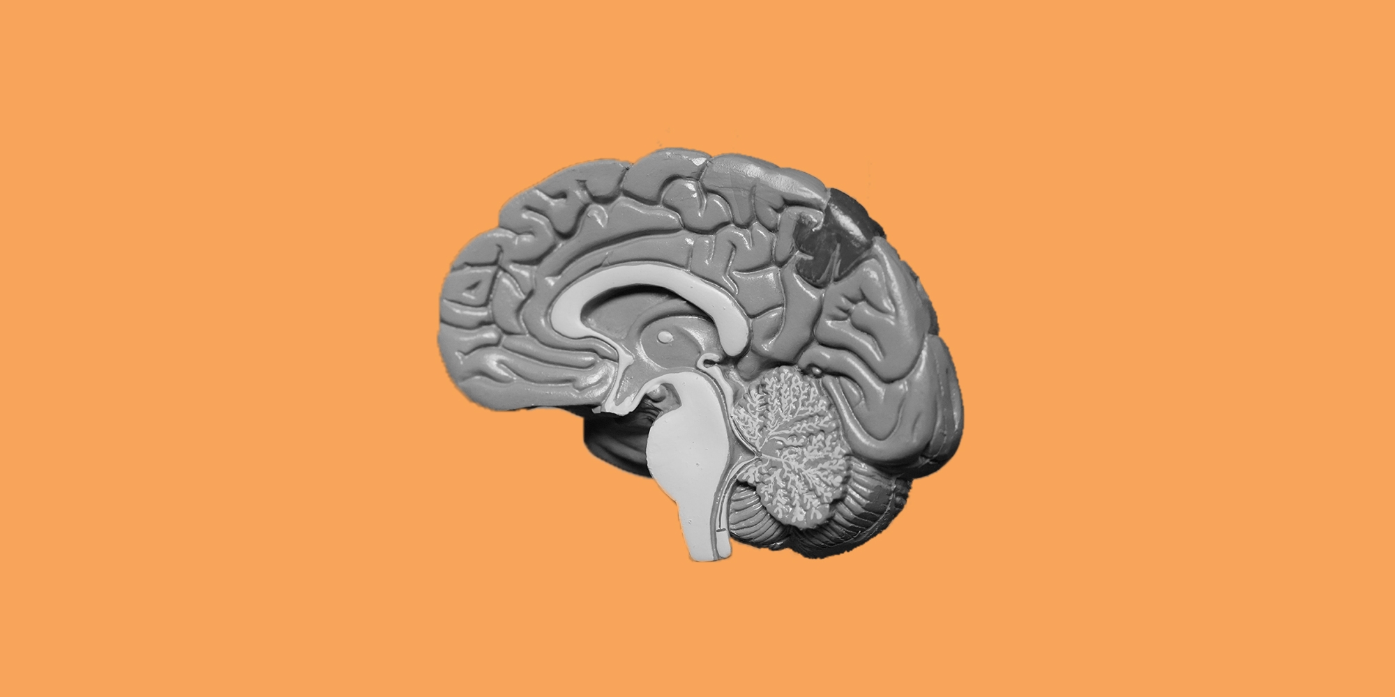 Blog_Brain_4 Blog_Brain_4